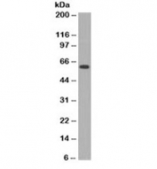 Western blot testing of HeLa cell lysate (nuclear fraction) with c-Myc antibody (clone MVH39-1). Expected molecular weight: 50~70kDa.