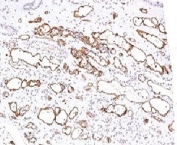 IHC testing of FFPE human kidney transplant tissue stained with C4d antibody (clone CPT4d-1). Staining of formalin-fixed tissues requires boiling tissue sections in 1mM EDTA, pH 7.5-8.5, for 10-20 min followed by cooling at RT for 20 min.