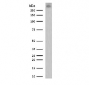 Western blot testing of human T47D cell lysate with MUC-1 antibody (clone MCN01-1). Expected molecular weight: 120-500 kDa depending on glycosylation level.