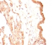 IHC testing of FFPE rat lung with Glypican-3 antibody (clone SGPN3-1).