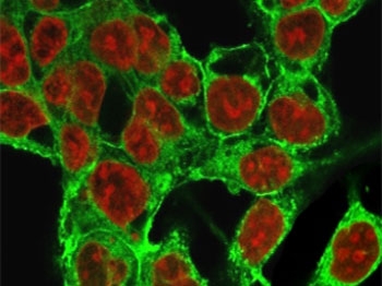Immunofluorescent staining of methanol-fixed HepG2 cells with Glypican-3 antibody (green, clone SGPN3-1) and Reddot nuclear stain (red).~