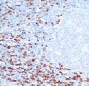 IHC analysis of FFPE human tonsil and CD8a antibody (clone CLDA8a-1). Staining of formalin-fixed tissues requires boiling tissue sections in pH 9 10mM Tris with 1mM EDTA for 10-20 min followed by cooling at RT for 20 min.