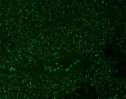 Immunofluorescent staining of AF488 conjugated Nucleoli Marker antibody and FFPE human colon carcinoma. HIER: boil tissue sections in pH6, 10mM citrate buffer, for 10-20 min and allow to cool before testing.