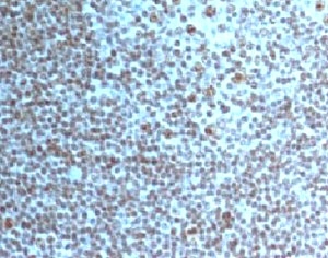 IHC testing of Nucleoli Marker antibody and FFPE human tonsil tissue. HIER: boil tissue sections in pH6, 10mM citrate buffer, for 10-20 min and allow to cool before testing.~
