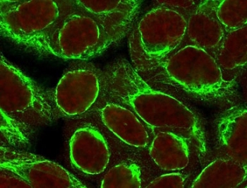 Immunofluorescent staining of permeabilized human HeLa cells with Cytokeratin 8 antibody (clone CYKN8-1, green) and Reddot nuclear stain (red).~