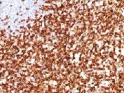 IHC testing of FFPE human tonsil and CD45RO antibody (clone CDLA45RO-1). HIER: boil in pH6 10mM citrate buffer for 10-20 minutes, followed by cooling at RT for 20 minutes, prior to staining.