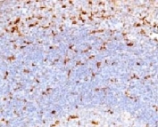 IHC testing of human tonsil and CD68 antibody (CDLA68-1). HIER: staining of formalin/paraffin tissues requires boiling tissue sections in 10mM citrate buffer, pH 6, for 10-20 min followed by cooling at RT for 20 min.
