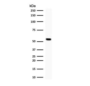 Western blot testing of human Jurkat cell lysate with TOP1MT antibody (clone TPIMT-1). Predicted molecular weight ~66 kDa.~
