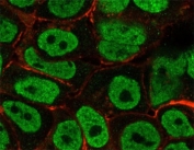 Immunofluorescent staining of PFA-fixed human MCF7 cells with p27Kip1 antibody (clone KIP27-1, green) and Phalloidin (red).