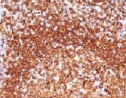 IHC testing of FFPE human tonsil and CD79a antibody (clone CDLA79a-1). HIER: formalin-fixed tissues requires boiling tissue sections in pH 9 10mM Tris with 1mM EDTA, for 10-20 min followed by cooling at RT for 20 min.