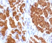 IHC testing of FFPE rat uterus and Calponin antibody (clone CLPN5-1). Staining of formalin-fixed tissues requires boiling tissue sections in 10mM Tris with 1mM EDTA, pH 9, for 10-20 min followed by cooling at RT for 20 min.