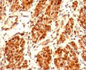 IHC testing of FFPE human uterus and Calponin antibody (clone CLPN5-1). Staining of formalin-fixed tissues requires boiling tissue sections in 10mM Tris with 1mM EDTA, pH 9, for 10-20 min followed by cooling at RT for 20 min.