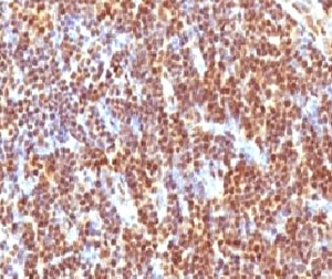 IHC testing of formalin-fixed, paraffin-embedded human tonsil with SUMO-2 antibody (clone S2MT-1). Required HIER: boil tissue sections in pH 9 10mM Tris with 1mM EDTA for 10-20 min.~