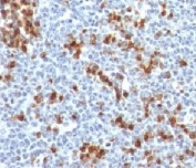 IHC testing of FFPE human tonsil and Kappa antibody (clone KC3L-1). Required HIER: boil tissue sections in 10mM citrate buffer, pH 6.0, for 10-20 min followed by cooling at RT for 20 min.
