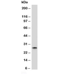 Western blot analysis of human spleen lysate and Kappa antibody (clone KC3L-1). Expected molecular weight: 23-25 kDa.~
