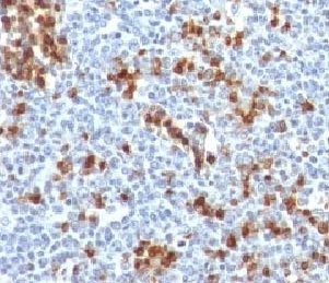 IHC testing of FFPE human tonsil and Kappa antibody (clone KC3L-1). Required HIER: boil tissue sections in 10mM citrat