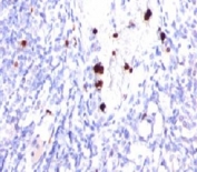 IHC testing of FFPE human tonsil and G-CSF antibody (PRPN2-1). Note cytoplasmic staining of granulocytes.