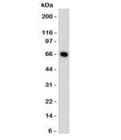 MCF7 cells western blot tested with Estrogen Receptor antibody (ER505). Predicted molecular weight ~67 kDa.