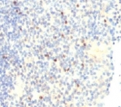 IHC analysis of FOXP3 antibody (clone FHBP3-1) and human tonsil tissue. Required HIER: boil tissue sections in 10mM Tris buffer with 1mM EDTA, pH 9, for 10-20 min.