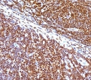 IHC staining of human tonsil with SUMO1 antibody (clone S1MT-2). Required HIER: boil tissue sections in pH 9 10mM Tris with 1mM EDTA for 10-20 min.