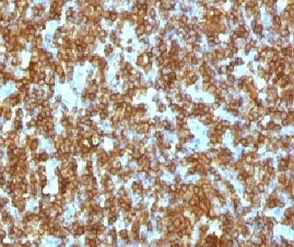 IHC testing of FFPE human tonsil and anti-CD45RA antibody (clone CDLA45RA-1). HIER: boil sections in pH6 10mM citrate buffer for 10-20 minutes, followed by cooling at RT for 20 minutes, prior to staining.~