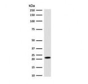Western blot testing of human HeLa cell lysate with p21 antibody (clone WAF21-1).