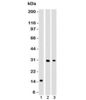 Western blot of 1) partial recombinant protein, 2) Panc-28 and 3) PANC1 cell lysate using CELA3B antibody (ELTS3B-1). Predicted molecular weight ~29 kDa.