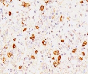 IHC testing of FFPE human pituitary and FSH-beta antibody (clone FLTPb-1 ). Staining of formalin-fixed tissues requires boiling tissue sections in pH 9 10mM Tris with 1mM EDTA for 10-20 min followed by cooling at RT for 20 minutes.