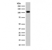 Western blot testing of human kidney lysate with Cadherin 16 antibody (clone KSCP2). Expected molecular weight: 90~130 kDa.