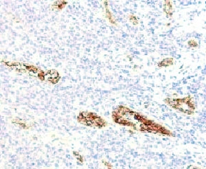IHC testing of FFPE human pancreas and von Willebrand Factor antibody (clone WFA52-2). Required HIER: boil tissue sections in pH 9 10mM Tris with 1mM EDTA for 10-20 min.~