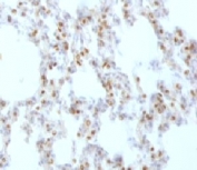 IHC testing of FFPE rat lung tissue with TTF-1 antibody (clone HBNK2-1). Required HIER: boil FFPE tissue sections in pH6 10mM citrate buffer for 10-20 minutes, followed by cooling at RT for 20 minutes.