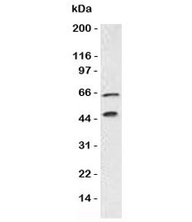 Western blot testing of Chromogranin A antibody and Panc-1 lysate. Predicted molecular weight is 50-75 kDa depending on glycosylation level.~