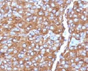 IHC analysis of formalin-fixed, paraffin-embedded human adrenal gland stained with Chromogranin