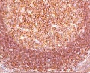 IHC staining of human tonsil with Bcl10 antibody (clone MUBC10). Required HIER: boil tissue sections in pH 9 10mM Tris with 1mM EDTA for 10-20 min.