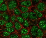 Immunofluorescent testing of PFA-fixed human MCF7 cells with SUMO2/3 antibody (green, clone S23MT-1) and Phalloidin (red).