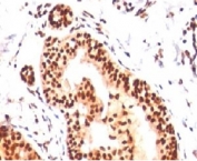 IHC analysis of human tonsil with SUMO2/3 antibody (clone S23MT-1). Required HIER: boil tissue sections in pH 9 10mM Tris with 1mM EDTA for 10-20 min.