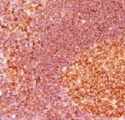 IHC staining of FFPE human tonsil tissue with MALT1 antibody (clone 4NMT-3). Required HIER: boil tissue sections in pH 9 10mM Tris with 1mM EDTA for 10-20 min.