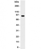 Western blot testing of human Daudi lysate with MALT1 antibody (clone 4NMT-3). Expected molecular weight ~92 kDa.