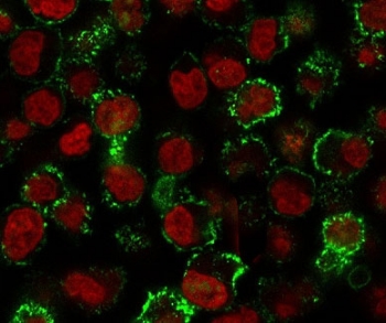 Immunofluorescent staining of human Raji cells with CD20 antibody (clone CDLA20-1, green) and Reddot nuclear stain (red).~