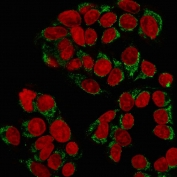 Immunofluorescent staining of MeOH-fixed human MCF7 cells with GnRHR antibody (green) and Reddot nuclear stain (red).