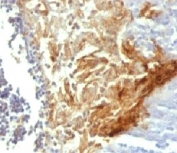 IHC testing of FFPE human tonsil with Involucrin antibody (clone INVO49). Staining of formalin-fixed tissues is enhanced by digestion with Trypsin or Protease XXV at 1mg/ml PBS for 5 min at 37oC. Enzyme digestion is more effective than citrate buffer based epitope unmasking.