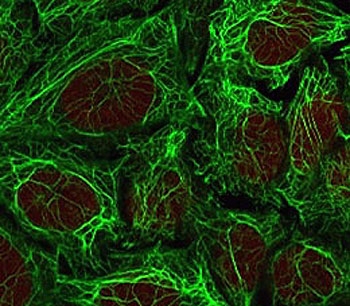 Immunofluorescent staining of methanol-fixed human HeLa cells with Cytokeratin 7 antibody (clone CTKN7-1, green) and Reddot nuclear stain (red).~