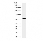 Western blot testing of human HeLa cell lysate with Cytokeratin 7 antibody (clone CTKN7-1). Predicted molecular weight ~51 kDa.