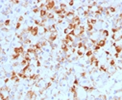 IHC testing of FFPE human pituitary with LHB antibody (clone CCGD1).