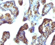 IHC testing of FFPE human placenta with Moesin antibody (clone EDLP70). HIER: steam section in pH6 citrate buffer for 20 min.