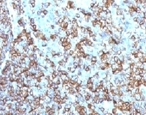 IHC testing of FFPE human tonsil and HLA-DRB1 antibody (clone MHDRb2). Staining of formalin-fixed tissues is enhanced by boiling tissue sections in pH 9 10mM Tris with 1mM EDTA for 10-20 min followed by cooling at RT for 20 min.~