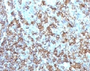 IHC testing of FFPE human tonsil and HLA-DRB1 antibody (clone MHDRb2). Staining of formalin-fixed tissues is enhanced by boiling tissue sections in pH 9 10mM Tris with 1mM EDTA for 10-20 min followed by cooling at RT for 20 min.
