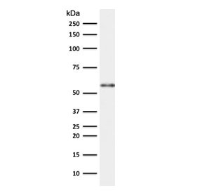 Western blot testing of human thymus lysate with Keratin 10 antibody (clone CTKN10-1). Predicted molecular weight ~59 kDa.~