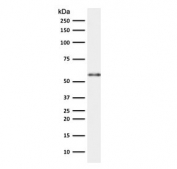 Western blot testing of human thymus lysate with Keratin 10 antibody (clone CTKN10-1). Predicted molecular weight ~59 kDa.