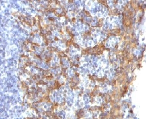 IHC testing of FFPE human prostate with Keratin 14 antibody (clone CTKN14-1). Staining of formalin-fixed tissues requires boiling tissue sections in pH 9 10mM Tris with 1mM EDTA for 10-20 min. followed by cooling at RT for 20 min.~